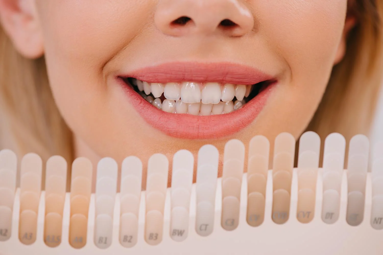 Professional Teeth Whitening 
